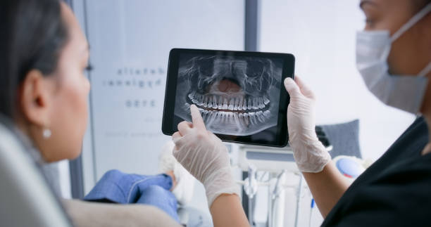 Licensed Tooth Extraction service in West Orange, TX - Smile Center Dentistry